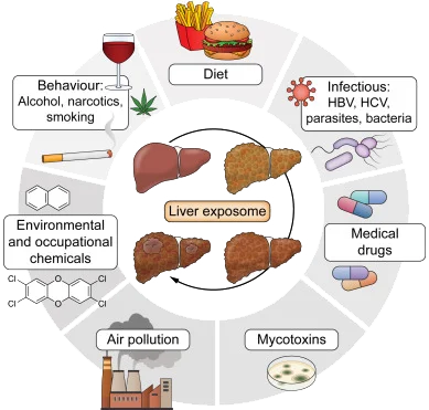 Infographic of Liver Exposome